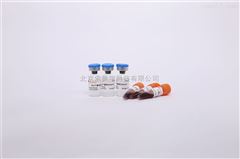 PR1400低分子量蛋白質Marker（分子量為14.4kD-97.4kD）